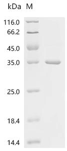 (Tris-Glycine gel) Discontinuous SDS-PAGE (reduced) with 5% enrichment gel and 15% separation gel.