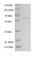 Recombinant Rat Zinc transporter ZIP13 (Slc39a13), partial – Figure 1 of 1