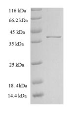 Recombinant Rat Zinc transporter ZIP13 (Slc39a13), partial – Figure 1 of 1