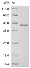 (Tris-Glycine gel) Discontinuous SDS-PAGE (reduced) with 5% enrichment gel and 15% separation gel.