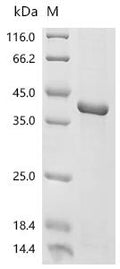 (Tris-Glycine gel) Discontinuous SDS-PAGE (reduced) with 5% enrichment gel and 15% separation gel.