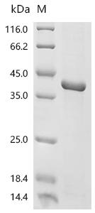 (Tris-Glycine gel) Discontinuous SDS-PAGE (reduced) with 5% enrichment gel and 15% separation gel.