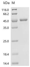 (Tris-Glycine gel) Discontinuous SDS-PAGE (reduced) with 5% enrichment gel and 15% separation gel.