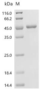 (Tris-Glycine gel) Discontinuous SDS-PAGE (reduced) with 5% enrichment gel and 15% separation gel.