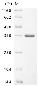(Tris-Glycine gel) Discontinuous SDS-PAGE (reduced) with 5% enrichment gel and 15% separation gel.