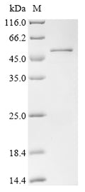 (Tris-Glycine gel) Discontinuous SDS-PAGE (reduced) with 5% enrichment gel and 15% separation gel.
