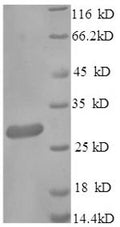 Recombinant Mouse Scavenger receptor cysteine-rich type 1 protein M130 (Cd163), partial – Figure 1 of 1