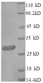 Recombinant Mouse Scavenger receptor cysteine-rich type 1 protein M130 (Cd163), partial – Figure 1 of 1