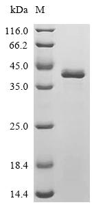 Recombinant Human Hereditary hemochromatosis protein (HFE), partial – Figure 1 of 1