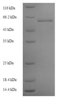 Recombinant Arabidopsis thaliana Lycopene beta cyclase, chloroplastic (LCY1) – Figure 1 of 1