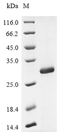 (Tris-Glycine gel) Discontinuous SDS-PAGE (reduced) with 5% enrichment gel and 15% separation gel.