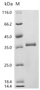 (Tris-Glycine gel) Discontinuous SDS-PAGE (reduced) with 5% enrichment gel and 15% separation gel.