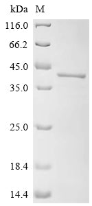 (Tris-Glycine gel) Discontinuous SDS-PAGE (reduced) with 5% enrichment gel and 15% separation gel.