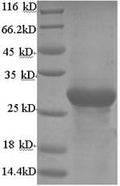 Recombinant Bovine Adiponectin (ADIPOQ) – Figure 1 of 1