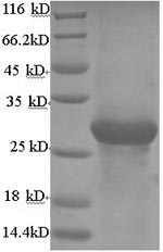 Recombinant Bovine Adiponectin (ADIPOQ) – Figure 1 of 1
