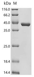 (Tris-Glycine gel) Discontinuous SDS-PAGE (reduced) with 5% enrichment gel and 15% separation gel.