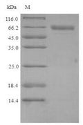 Recombinant Mouse Putative phospholipase B-like 2 (Plbd2) – Figure 1 of 1