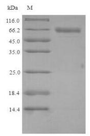 Recombinant Mouse Putative phospholipase B-like 2 (Plbd2) – Figure 1 of 1