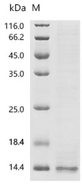 (Tris-Glycine gel) Discontinuous SDS-PAGE (reduced) with 5% enrichment gel and 15% separation gel.