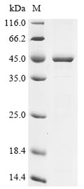 (Tris-Glycine gel) Discontinuous SDS-PAGE (reduced) with 5% enrichment gel and 15% separation gel.