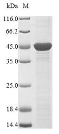 (Tris-Glycine gel) Discontinuous SDS-PAGE (reduced) with 5% enrichment gel and 15% separation gel.