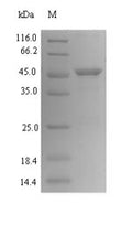 (Tris-Glycine gel) Discontinuous SDS-PAGE (reduced) with 5% enrichment gel and 15% separation gel.