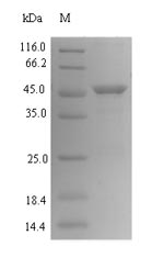 (Tris-Glycine gel) Discontinuous SDS-PAGE (reduced) with 5% enrichment gel and 15% separation gel.