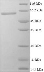 Recombinant Bacillus subtilis Modification methylase BglII (bglIIM) – Figure 1 of 1