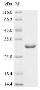 (Tris-Glycine gel) Discontinuous SDS-PAGE (reduced) with 5% enrichment gel and 15% separation gel.