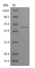 (Tris-Glycine gel) Discontinuous SDS-PAGE (reduced) with 5% enrichment gel and 15% separation gel.