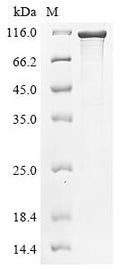 (Tris-Glycine gel) Discontinuous SDS-PAGE (reduced) with 5% enrichment gel and 15% separation gel.
