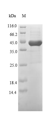(Tris-Glycine gel) Discontinuous SDS-PAGE (reduced) with 5% enrichment gel and 15% separation gel.