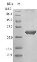 (Tris-Glycine gel) Discontinuous SDS-PAGE (reduced) with 5% enrichment gel and 15% separation gel.