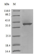 (Tris-Glycine gel) Discontinuous SDS-PAGE (reduced) with 5% enrichment gel and 15% separation gel.