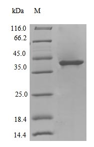 (Tris-Glycine gel) Discontinuous SDS-PAGE (reduced) with 5% enrichment gel and 15% separation gel.