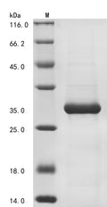 (Tris-Glycine gel) Discontinuous SDS-PAGE (reduced) with 5% enrichment gel and 15% separation gel.