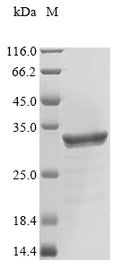 (Tris-Glycine gel) Discontinuous SDS-PAGE (reduced) with 5% enrichment gel and 15% separation gel.