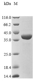 (Tris-Glycine gel) Discontinuous SDS-PAGE (reduced) with 5% enrichment gel and 15% separation gel.