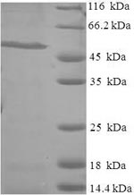 Recombinant Human Ras-specific guanine nucleotide-releasing factor RalGPS1 (RALGPS1) – Figure 1 of 1