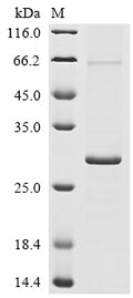 (Tris-Glycine gel) Discontinuous SDS-PAGE (reduced) with 5% enrichment gel and 15% separation gel.