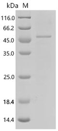 Recombinant Tetraodon nigroviridis N-acetyltaurine hydrolase (pter) – Figure 1 of 1