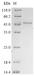 (Tris-Glycine gel) Discontinuous SDS-PAGE (reduced) with 5% enrichment gel and 15% separation gel.