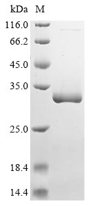 (Tris-Glycine gel) Discontinuous SDS-PAGE (reduced) with 5% enrichment gel and 15% separation gel.