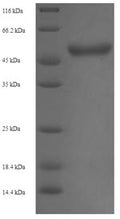 Recombinant Staphylococcus aureus Malonyl CoA-acyl carrier protein transacylase (fabD) – Figure 1 of 1