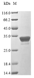 (Tris-Glycine gel) Discontinuous SDS-PAGE (reduced) with 5% enrichment gel and 15% separation gel.