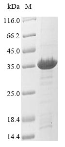 (Tris-Glycine gel) Discontinuous SDS-PAGE (reduced) with 5% enrichment gel and 15% separation gel.