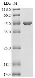 (Tris-Glycine gel) Discontinuous SDS-PAGE (reduced) with 5% enrichment gel and 15% separation gel.
