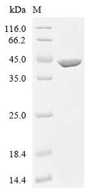 (Tris-Glycine gel) Discontinuous SDS-PAGE (reduced) with 5% enrichment gel and 15% separation gel.