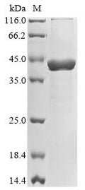 (Tris-Glycine gel) Discontinuous SDS-PAGE (reduced) with 5% enrichment gel and 15% separation gel.