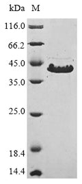 (Tris-Glycine gel) Discontinuous SDS-PAGE (reduced) with 5% enrichment gel and 15% separation gel.